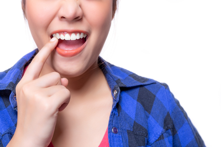 ¿Qué son las troneras dentales?